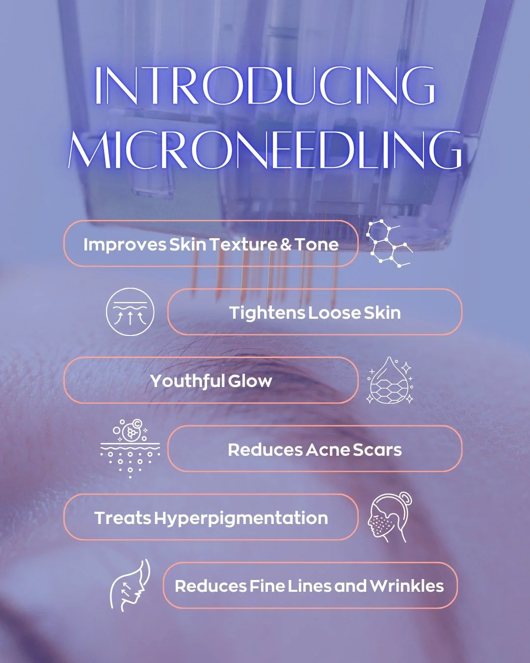✨ Microneedling is officially here at Erin Meier Aesthetics! ✨
This is my secret weapon for incredible skin. It's not just about tiny needles - it's about flooding your skin with exosomes, growth factors, and stem cells that do all the heavy lifting