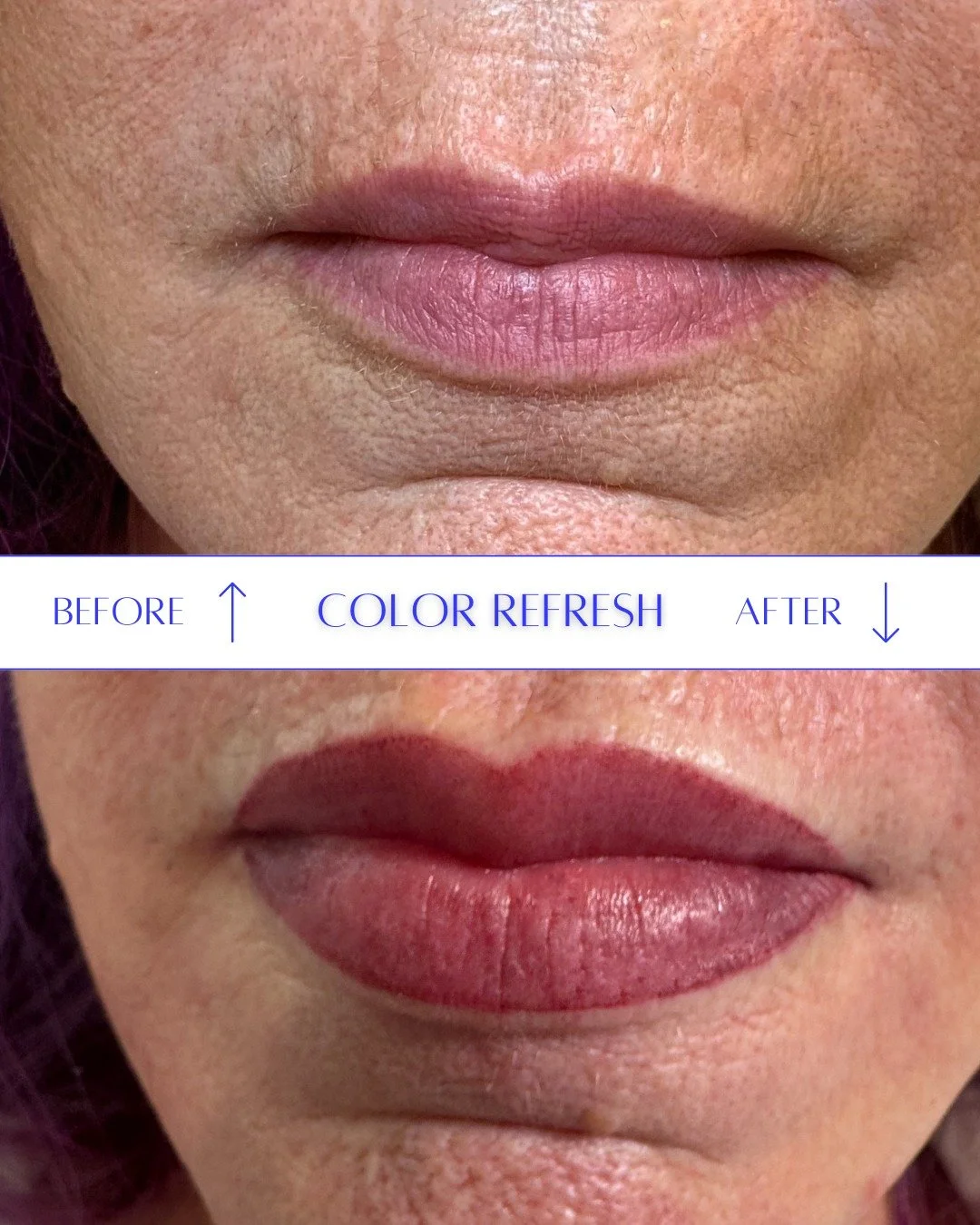 Toss the Lipstick! 💄 This is Permanent Lip Perfection!
We started with her initial permanent makeup application to define the ideal shape, and then she came back for her essential Color Refresh, which sealed the deal on a beautiful, balanced shade.