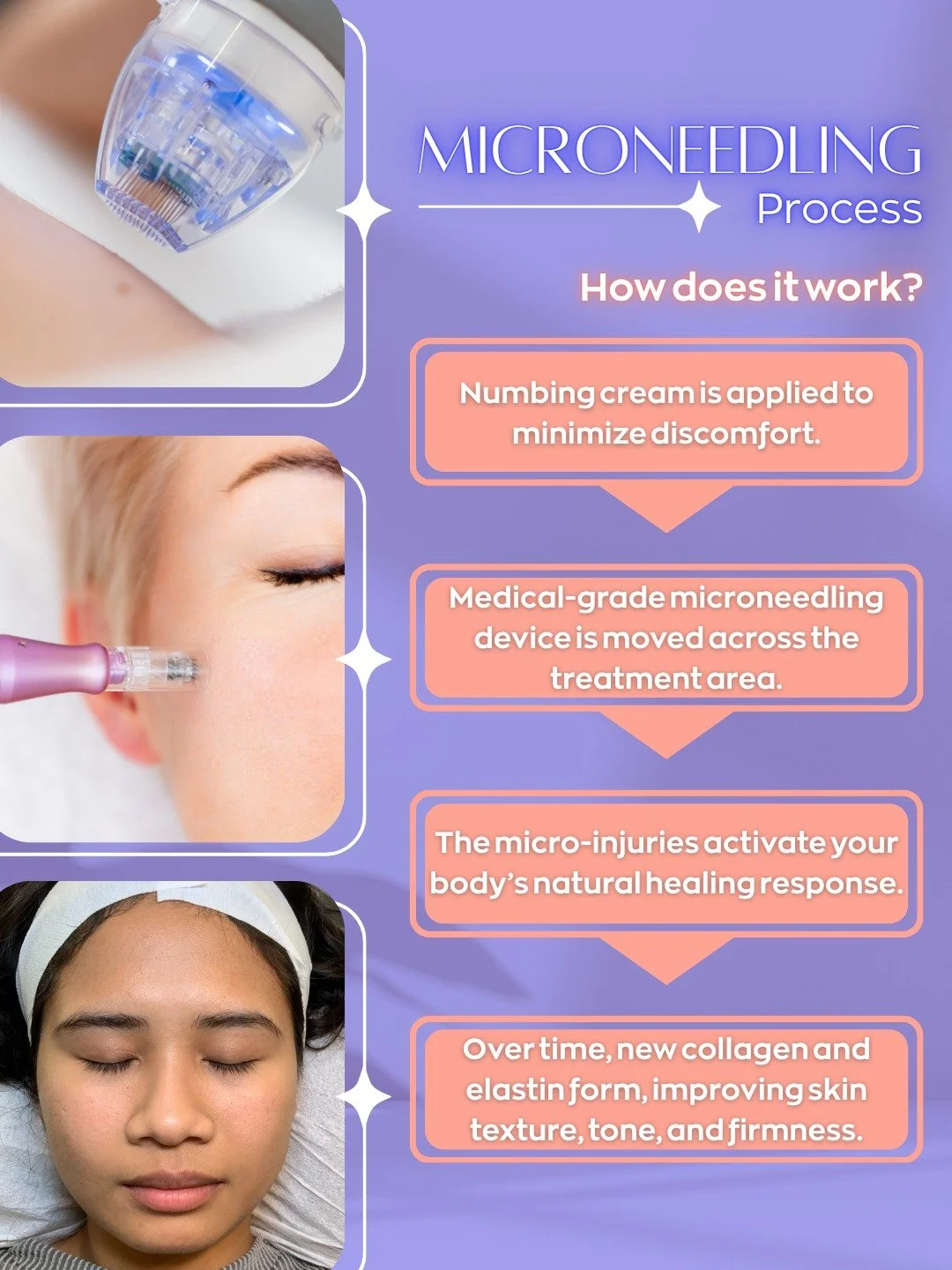 Demystifying the Microneedling Process! It may sound technical, but the steps are straightforward and the results are game-changing!

Book your treatment today and let's get you on the path to your best skin! Tap the link in bio to schedule!

#Micron