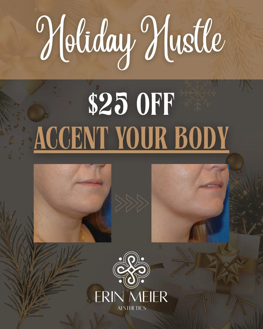 Sleigh Your Holiday Look! ✨👗

The Holiday Hustle is bringing the heat to OKC! Get ready to feel your absolute best in that holiday dress with my latest deal.

$25 OFF Accent Your Body Services! Get it for just $75 (Regularly $100).

Tighten, tone, a