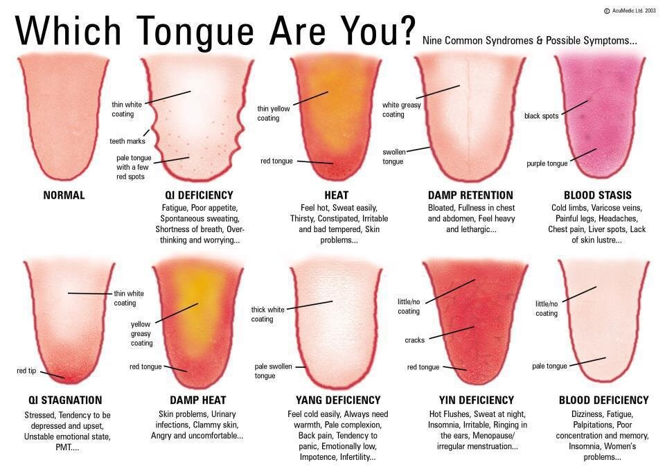 Open Up Say Tongue Diagnosis in TCM — Six Branches Family Acupuncture