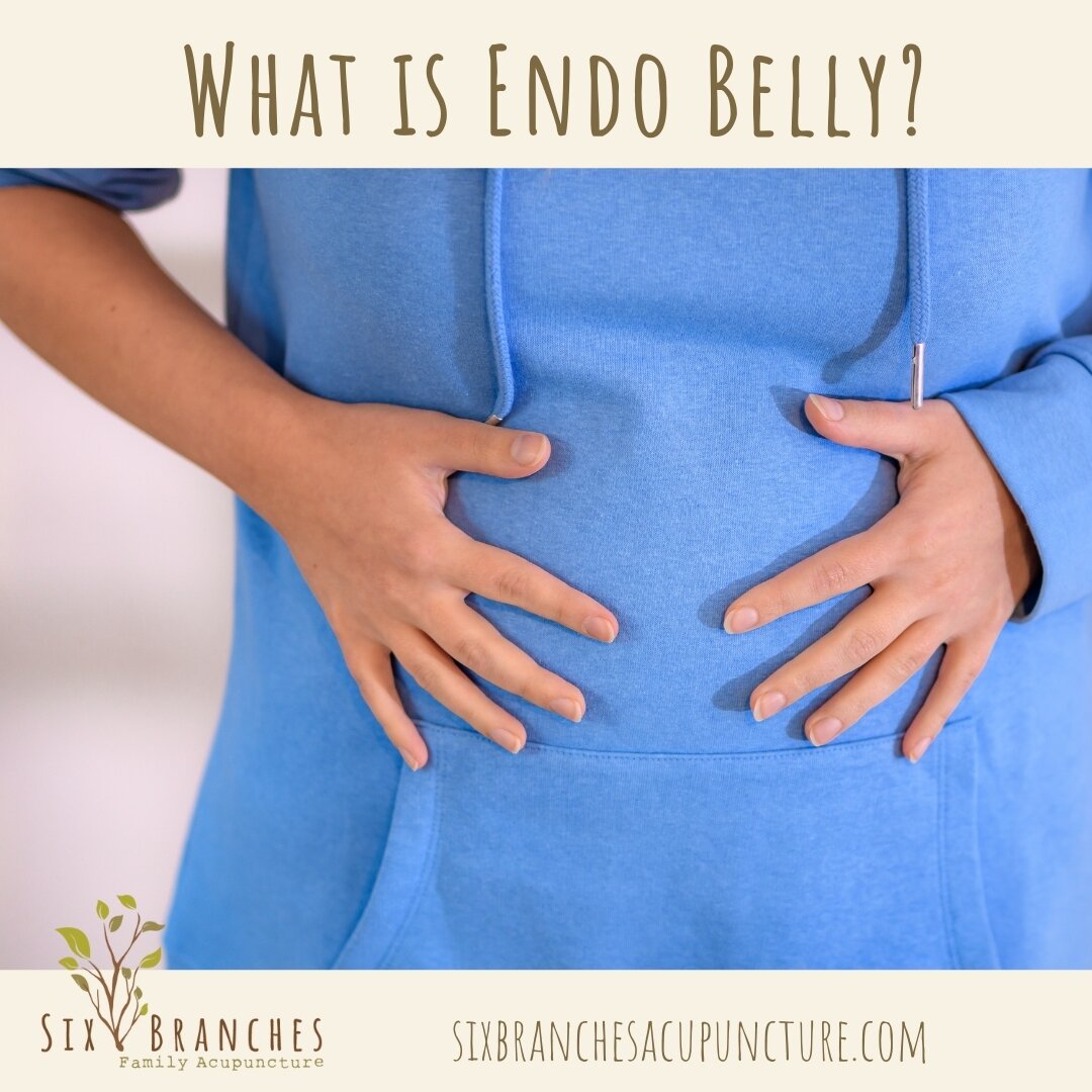 What is Endo Belly?

&quot;Endo belly&quot; refers to the abdominal distention or bloating that people with endometriosis experience. Endo belly can happen during your period or it could persist throughout the cycle.

Here are the symptoms of Endo be