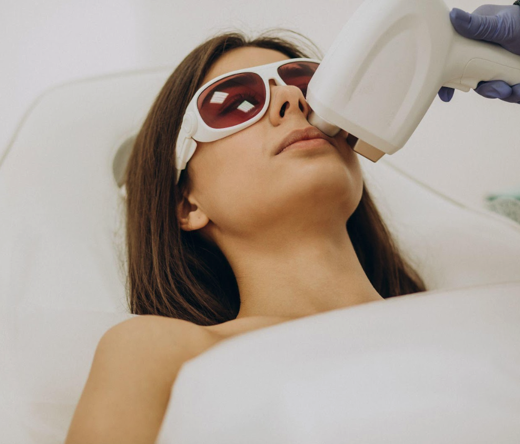 Say Goodbye to Unwanted Hair: Upper Lip Laser Treatments Made Easy