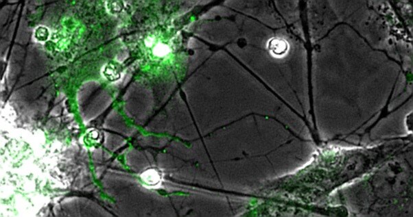 VZV (green) traveling along IPS-derived motor neuron processes to infect adjacent cell