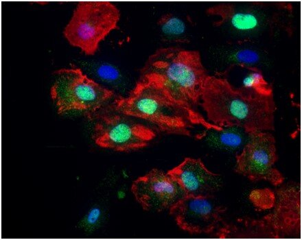 VZV-infected perineurial cells (red) re-localize claudin-1 to nucleus