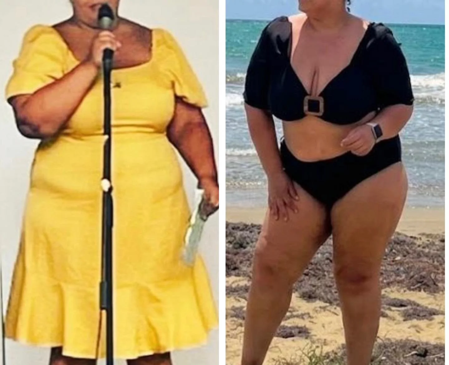 Acaba de empezar su proceso de adelgazamiento… y ya irradia confianza. ✨

No se trata solo de un cambio físico, sino de cómo empiezas a verte y a sentirte desde dentro.

#BienestarIntegral #HormonasBioidénticas #SaludFemenina #sculp