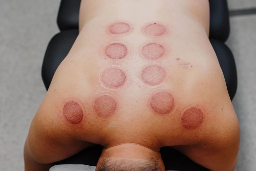 Myofascial Release