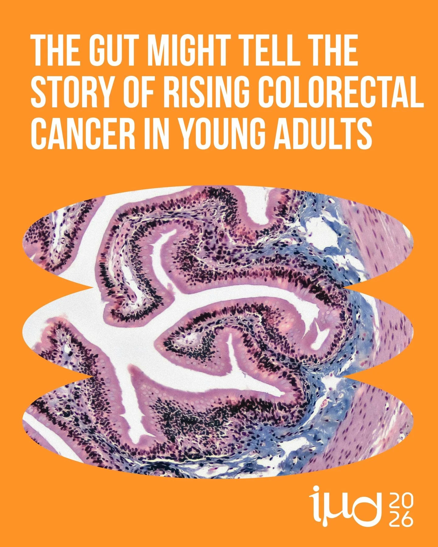 🧬 Could the gut be part of the story behind rising colon cancer rates in young adults?
.
Our latest blog written by Zehra Esra Ilhan takes a closer look at how shifts in the gut environment might connect to the rise in early‑onset colorectal cancer,