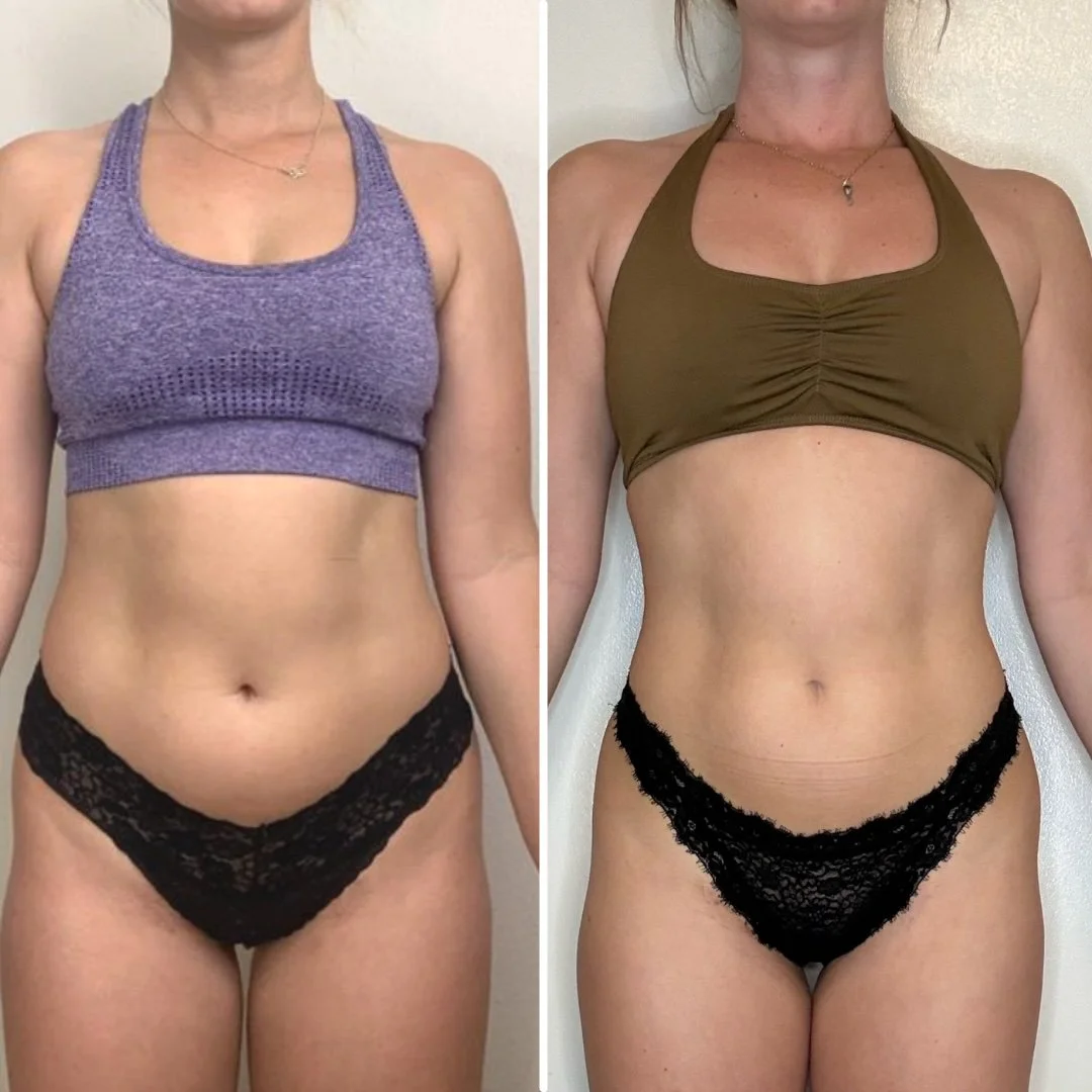 Before and after front-view photos of a coaching client in a sports bra and black bottomsFront body composition transformation and healthy weight loss results through custom macro coaching