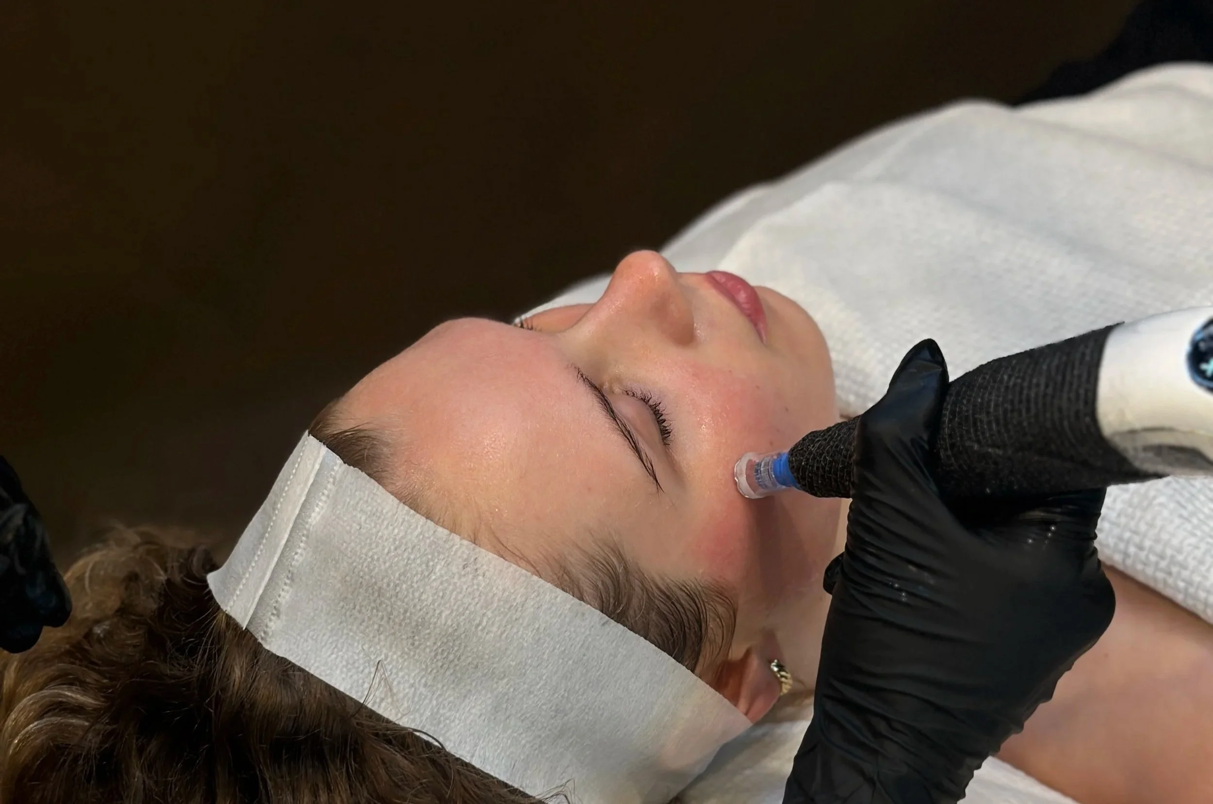 Skin Needling Collagen Boost: A Guide to Firmer, Refined-Looking Skin