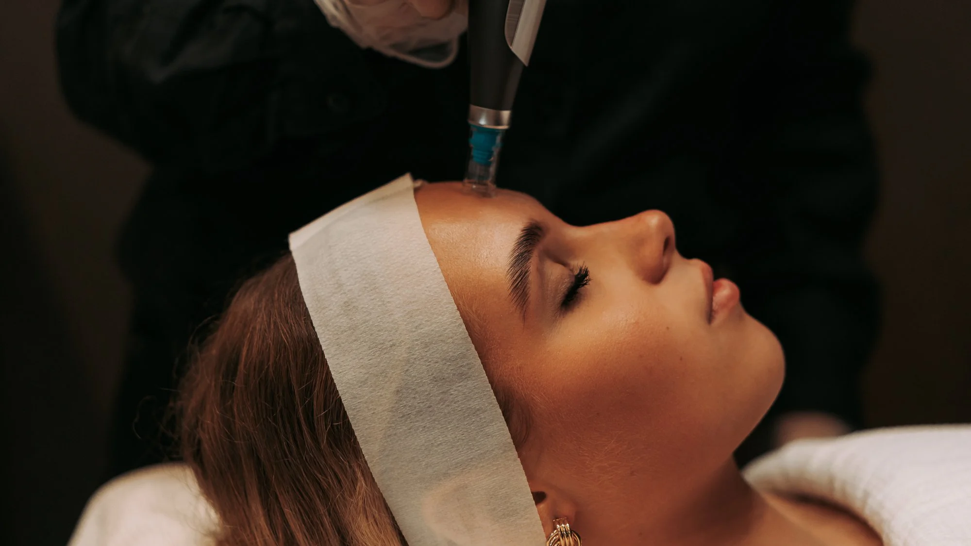 Skin needling at Mediluxe