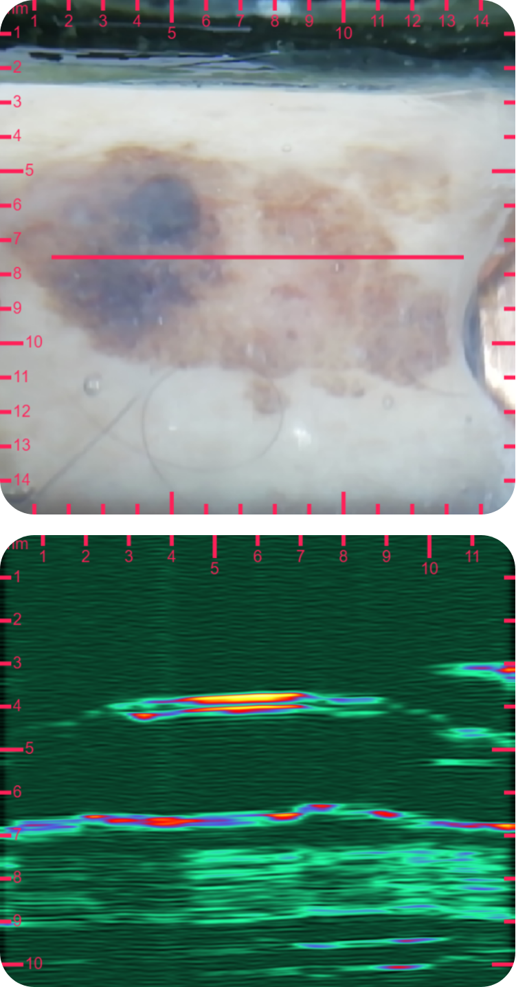 a_keratosis.png