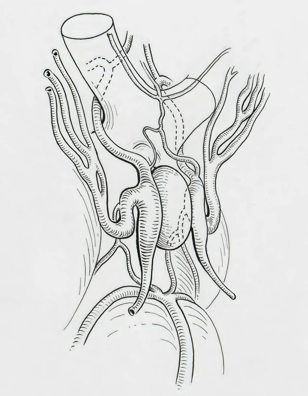 This Underrated System Powers Your Well-Being - Lymphatics