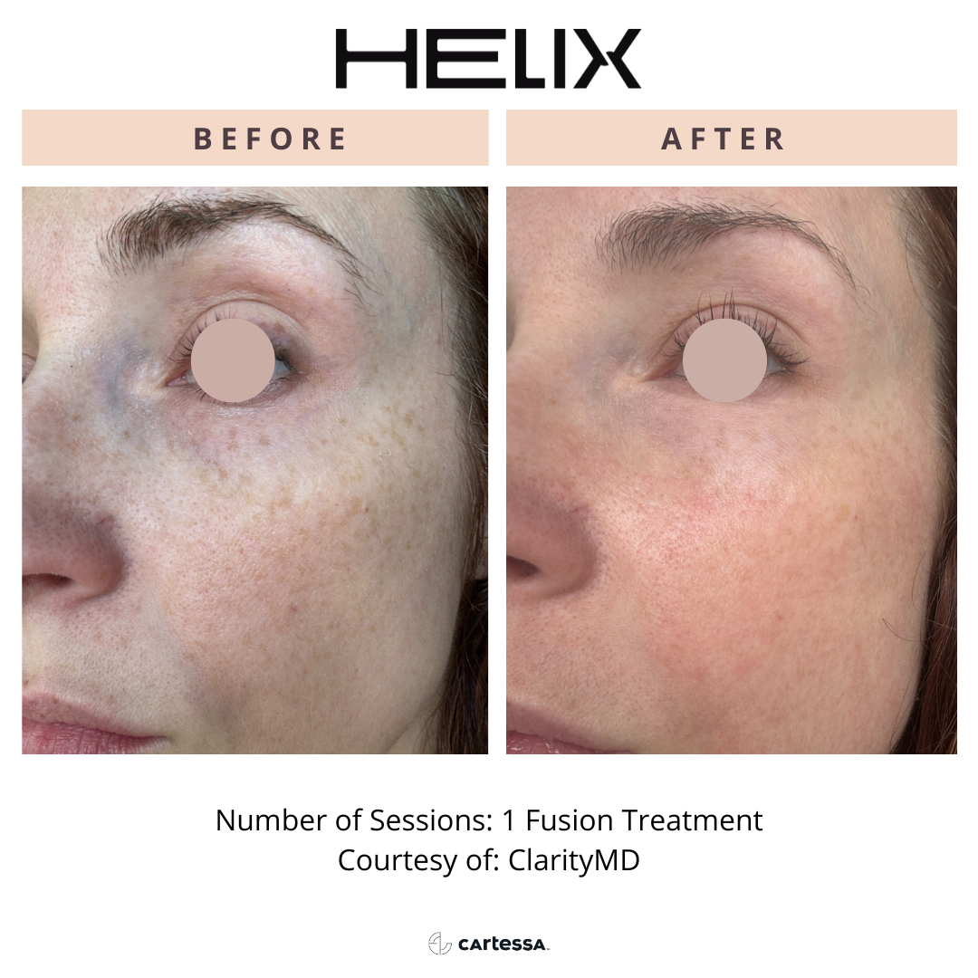 Copy of BeyondBeautyMedSpaDekaPulse1173653551247.png