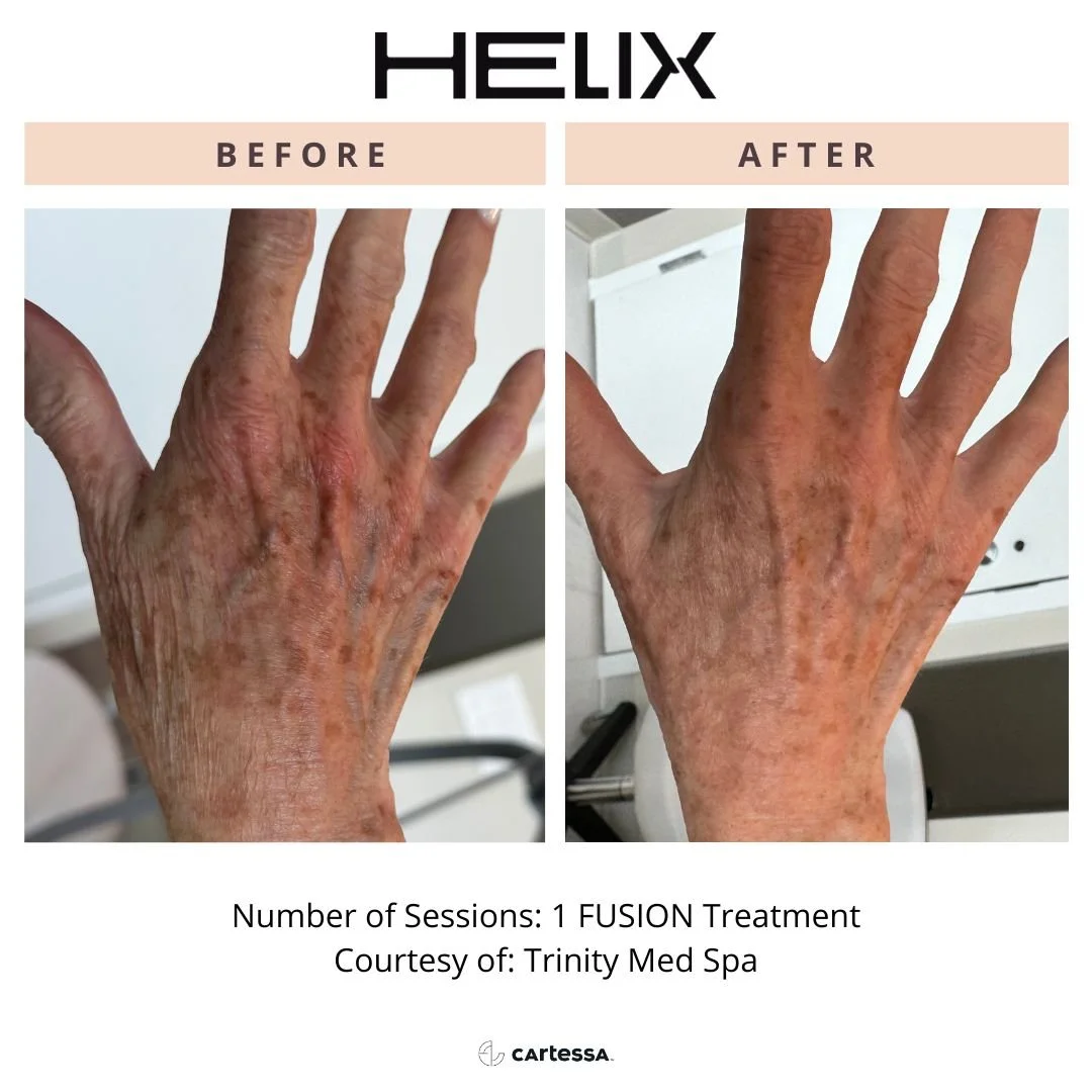 Copy of TrinityMedSpaHandsBA2172980430454.jpg