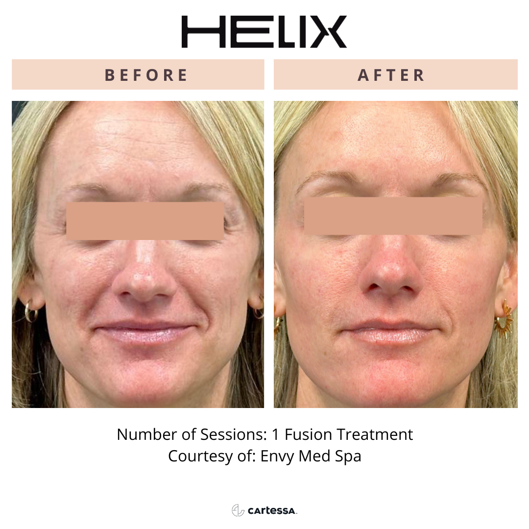 Copy of Helix19173758257180.png