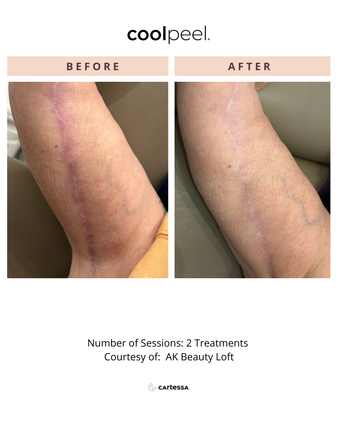 Copy of inforejuvsfcom174595298992.png