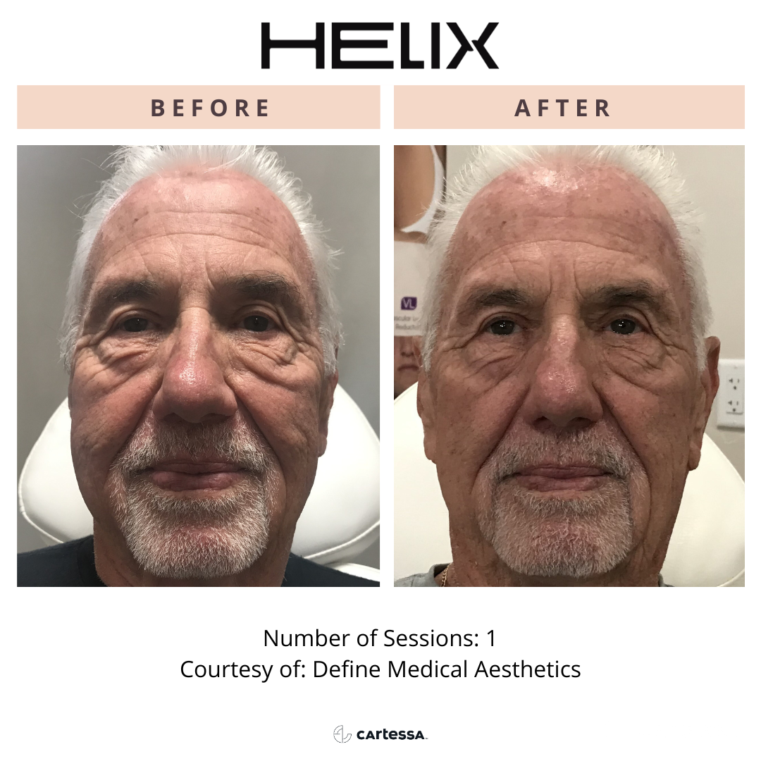 Copy of HelixBANEWTemplate172434048817.png