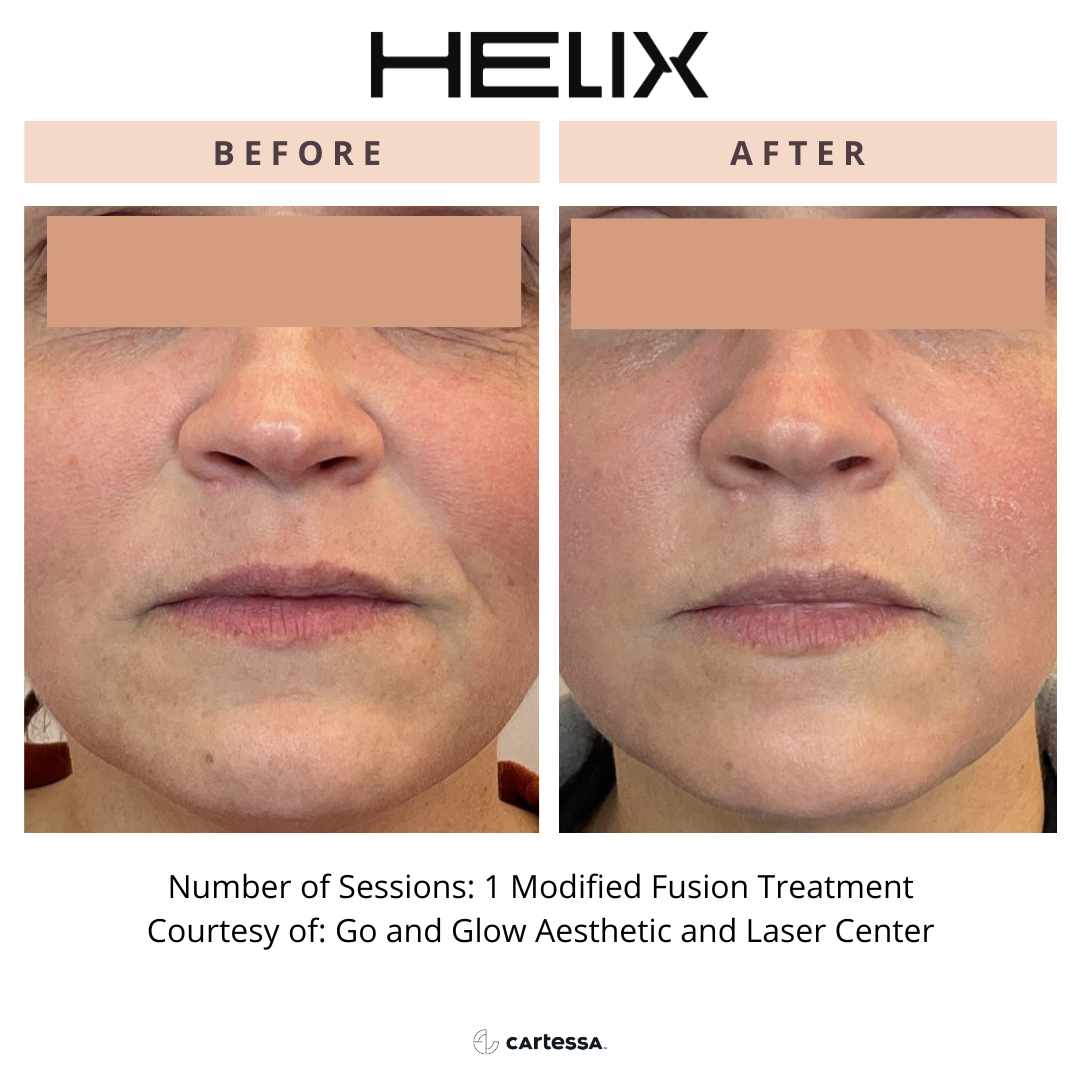 Copy of Helix16173758258832.png