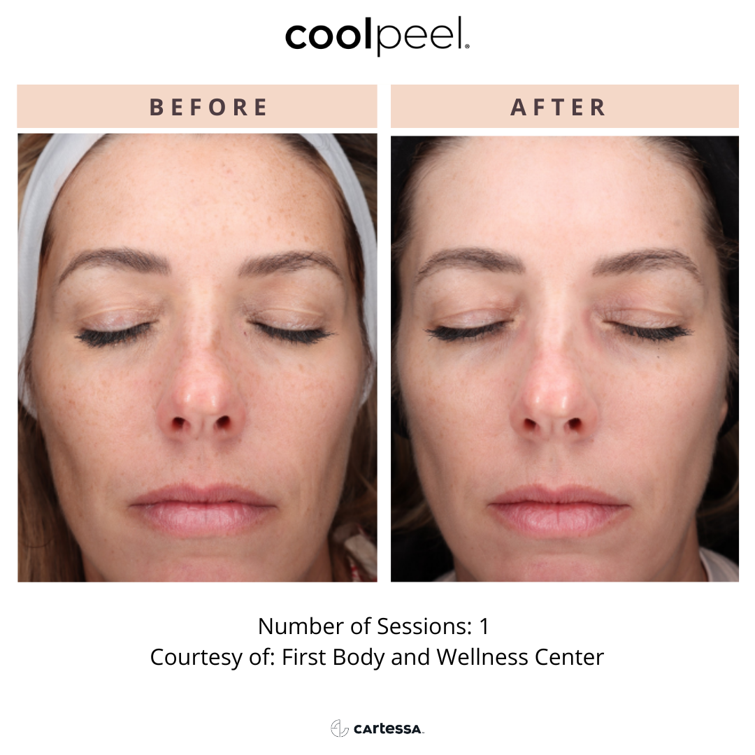 Copy of CoolPeelTemplate12173774057026.png