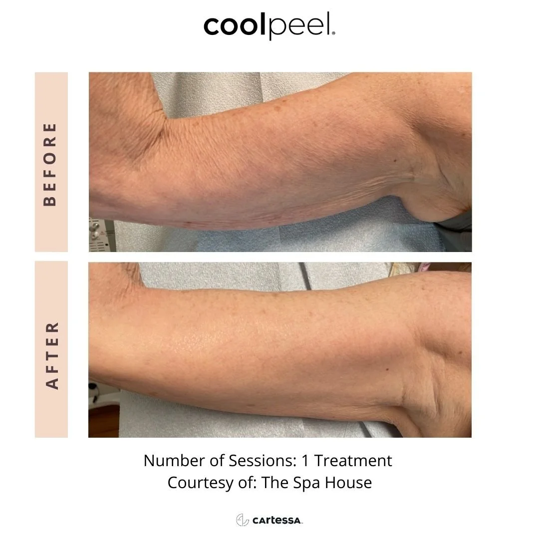 CoolPeelArmsTheSpaHouse173437797226.jpg