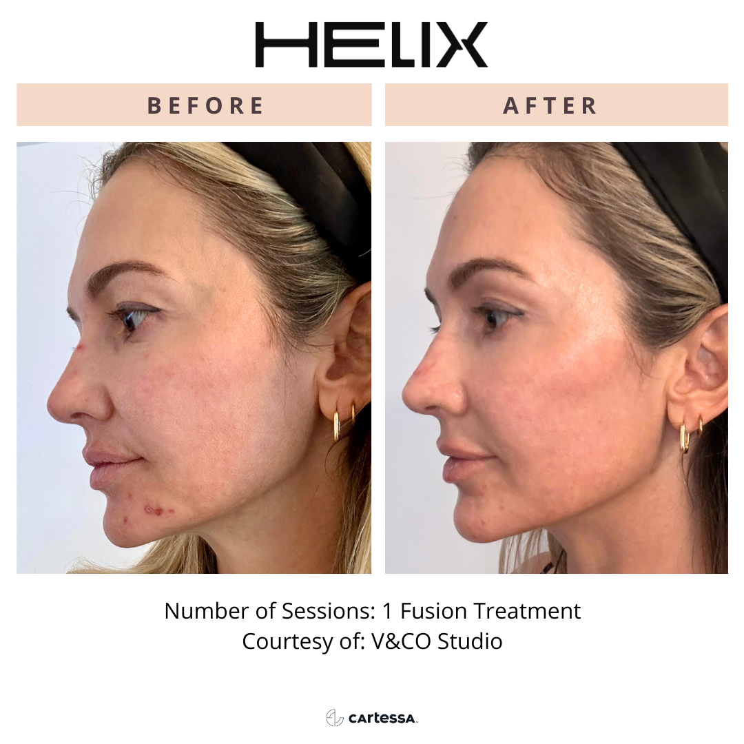 Copy of Helix192173758256192.png