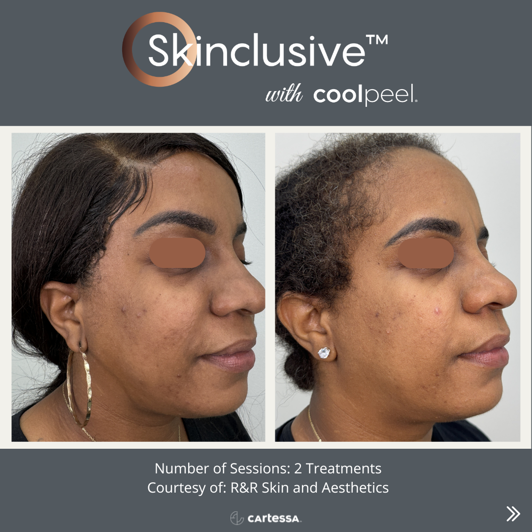 Copy of SkinclusiveCaseStudyPostTemplate1173437448935.png