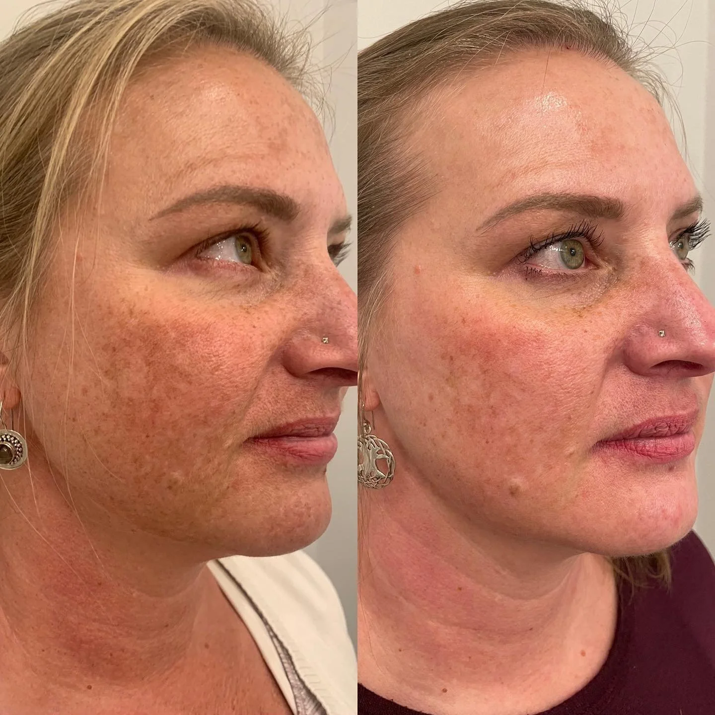 @ciaobellagp Series of Perfection Lift and At-Home Care (1).jpg