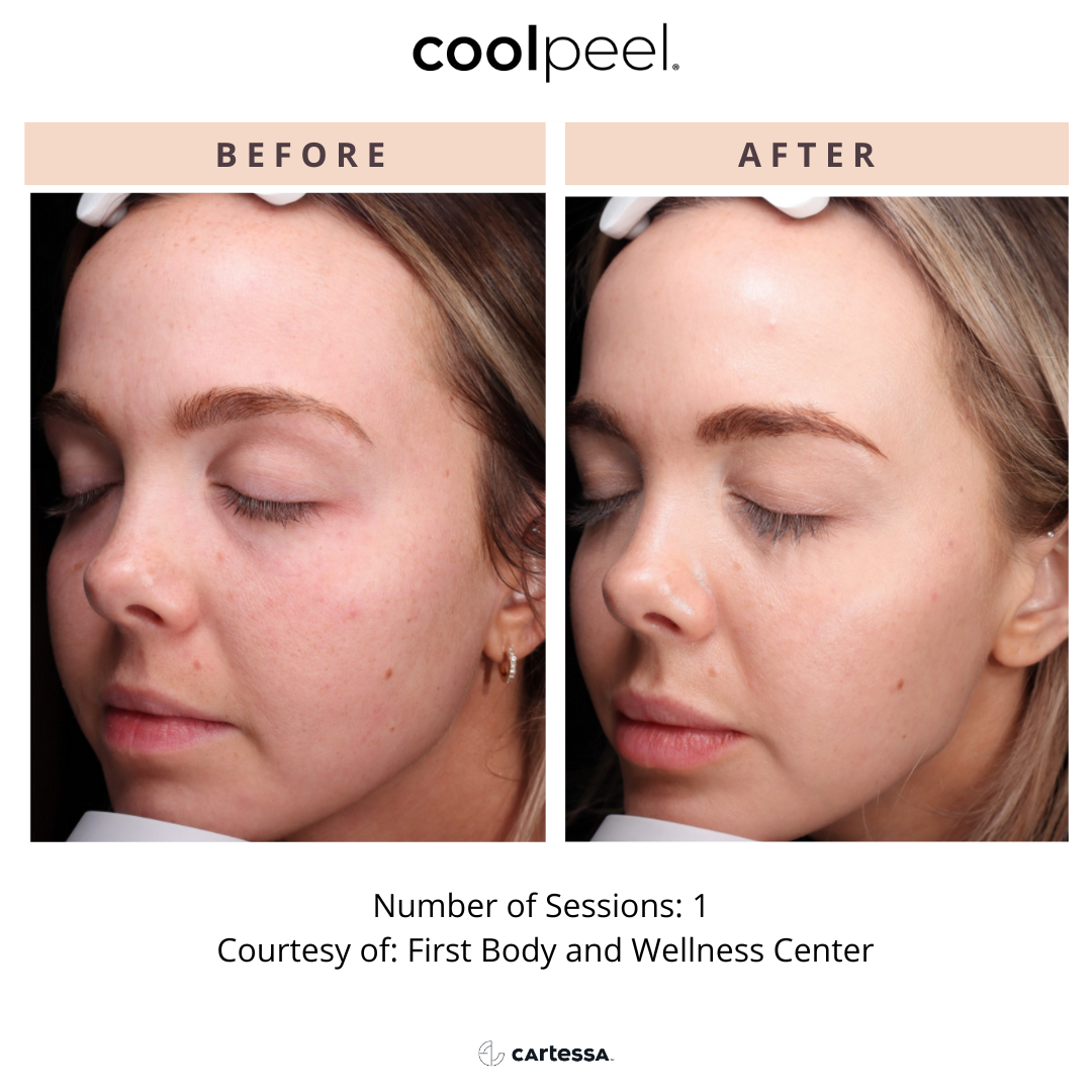 Copy of CoolPeelTemplate11173774025718.png