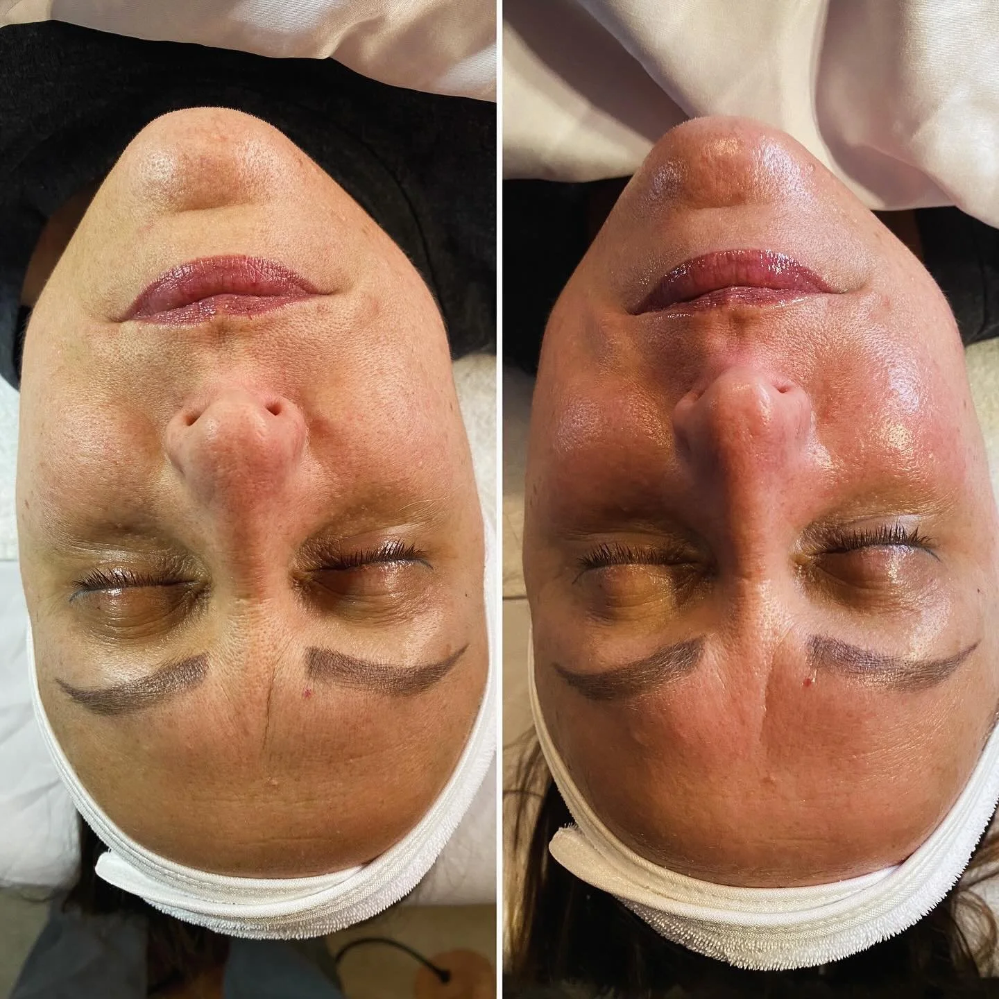 @derma.haus_wpg_Signature Lift (1).jpg