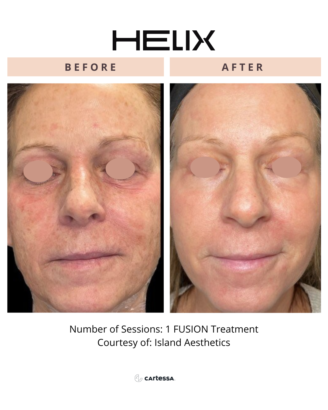 Copy of TrinityMedSpaHandsBA8174077383654.png