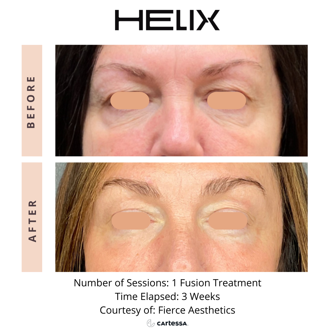 Copy of Helix9a173758262262.png