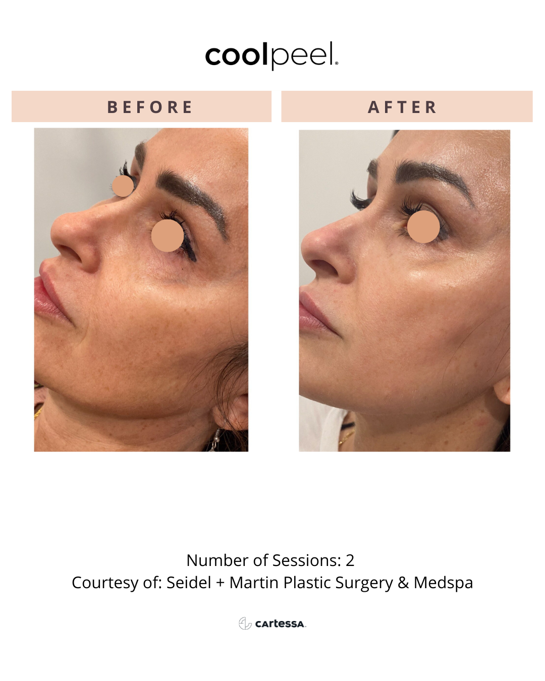 Copy of CoolPeelTemplate25174077231538.png