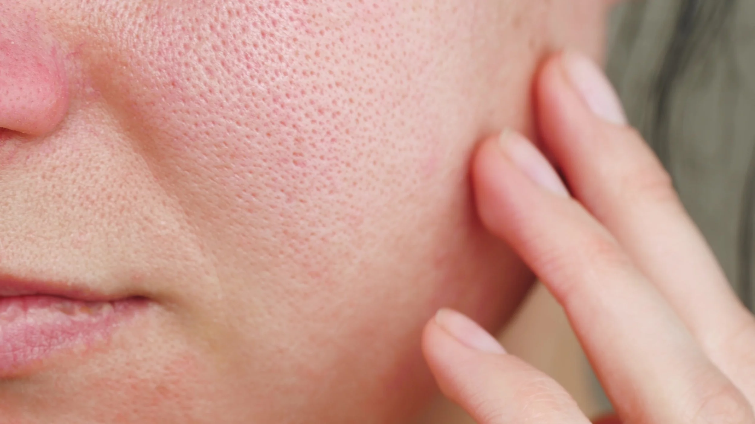 The Truth About Pore Size &amp; How Med Spa Treatments May Be Able to Help