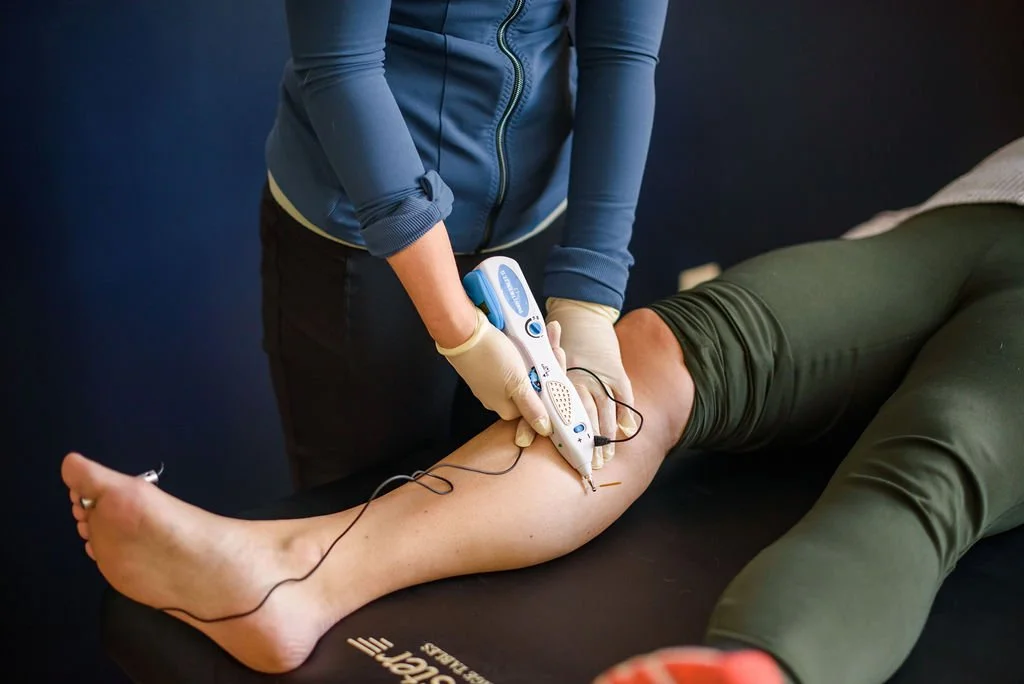 Dry Needling — Anchor Physical Therapy & Performance