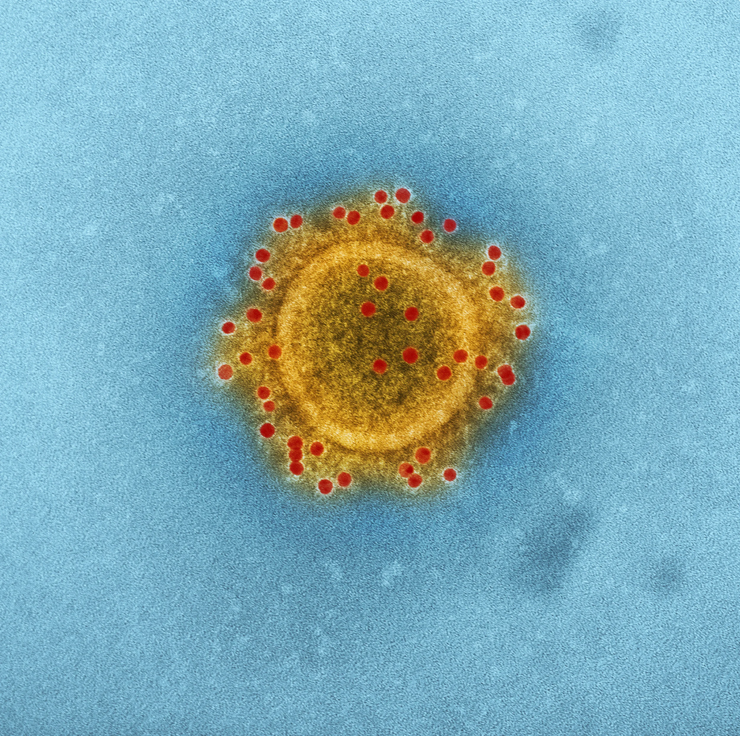 Do-It-Yourself Cheek Swab Tested As Next Best Thing To Detect Coronavirus