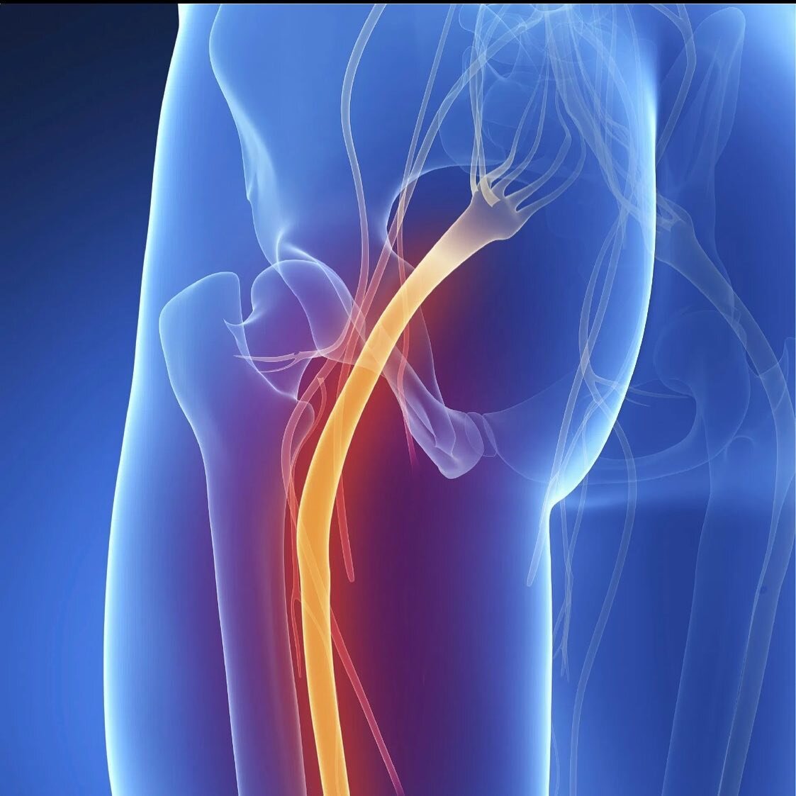 The Sciatic nerve originates in the low back, going from the upper thigh all the way down the leg. Painful throbbing in the low back and limbs can be caused by a condition known as sciatica. 

The biggest cause of sciatic pain are herniated spinal di