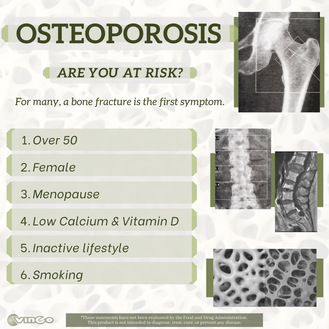 Risk Factors for Osteoporosis