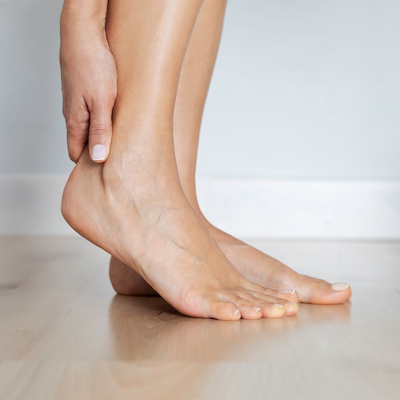 Varicose (spider) veins: Treatment, causes, symptoms, and more
