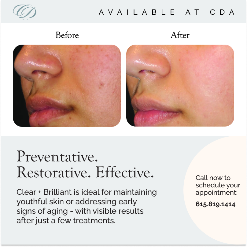 Clear + Brilliant 4.png