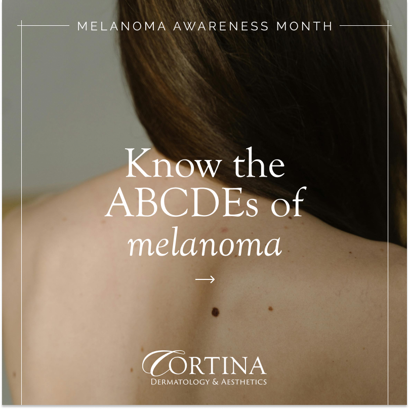 IDENTIFY SKIN CANCER 1.png