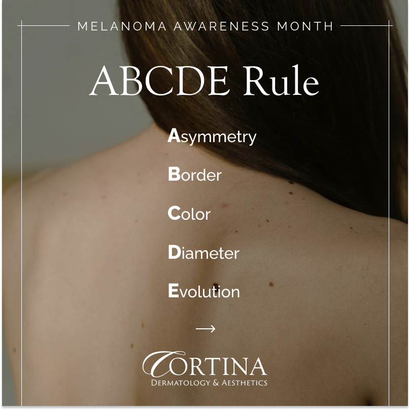 IDENTIFY SKIN CANCER 2.png