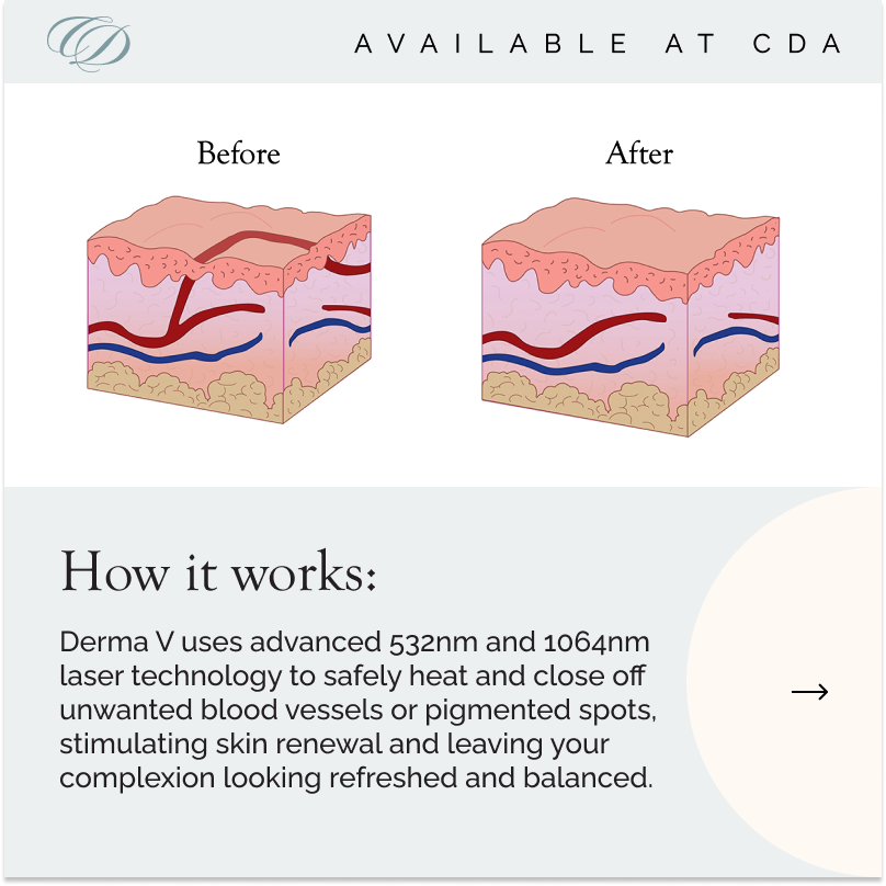 DermaV 5.png