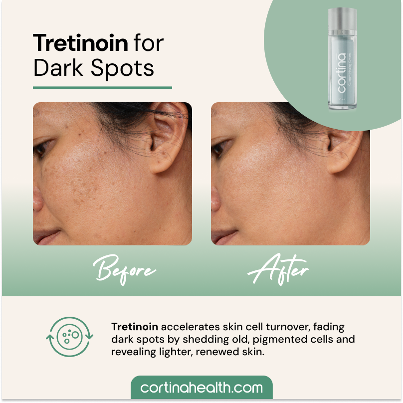 TRET DARK SPOTS 1.png