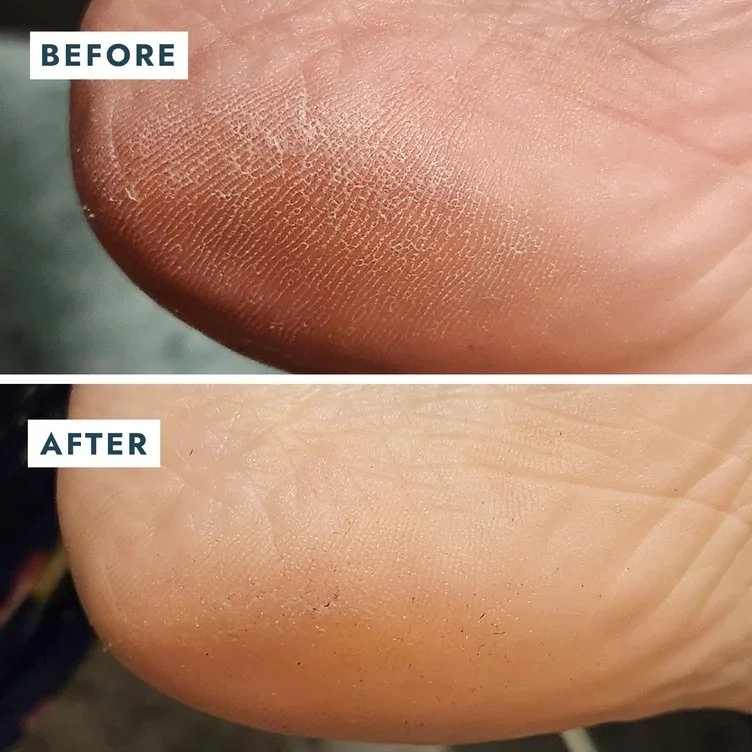 Voesh-Heel-Repair-Example.jpeg