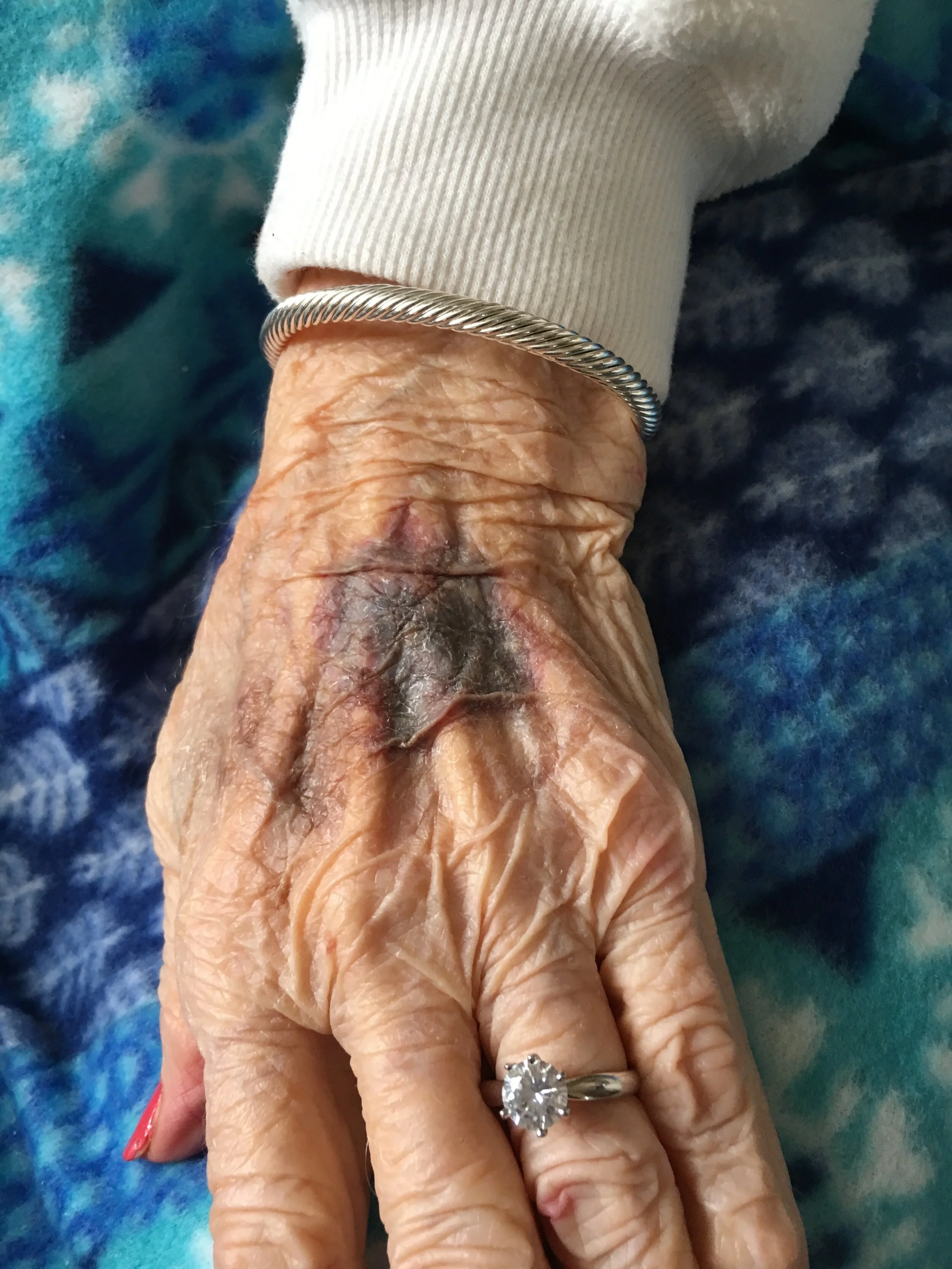 Eldercare: Five Triggers of Discouragement