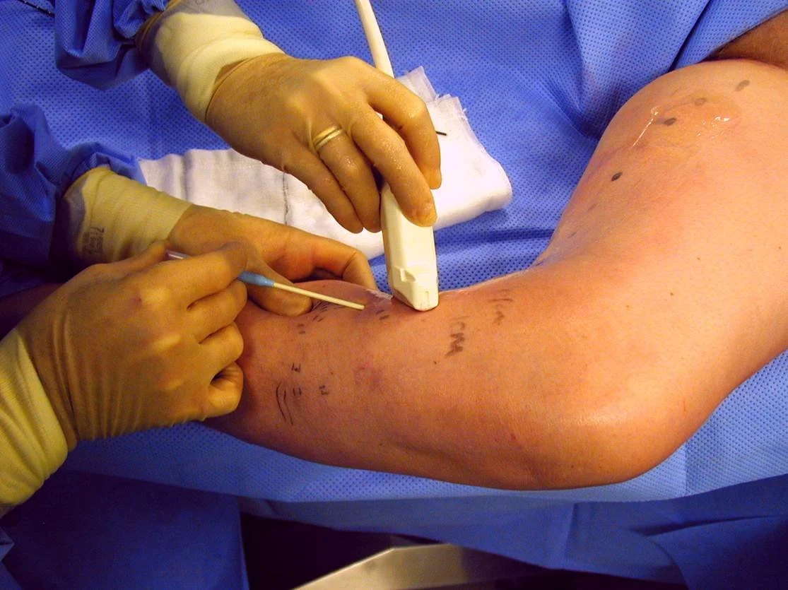 Madison Ranalli: A Day in the Life of Vascular Surgery