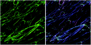 collagen architecture-image analysis-scar therapy.jpeg