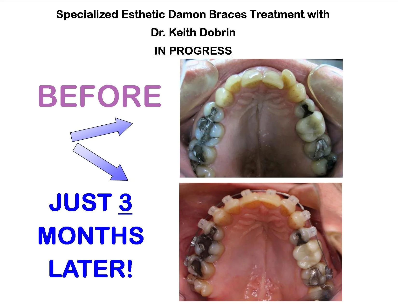 progress with damon clear gvan.jpg