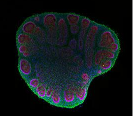 Little Brains, Big Discoveries: How Brain Organoids Are Transforming Neuroscience
